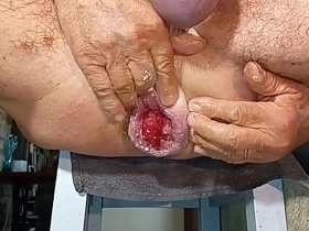 扩肛侠2025-14 dc hunter asian detached sex videos