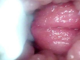 内窥镜拍下我老婆的G点。教学视频 chinese gay porn gaydar